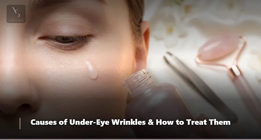The best way to remove wrinkles around the eyes
