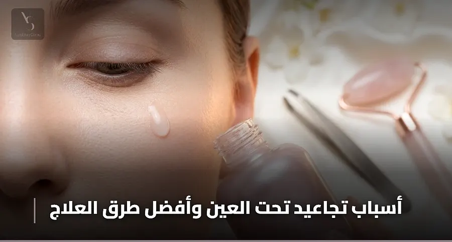 افضل طريقة لازالة التجاعيد حول العين