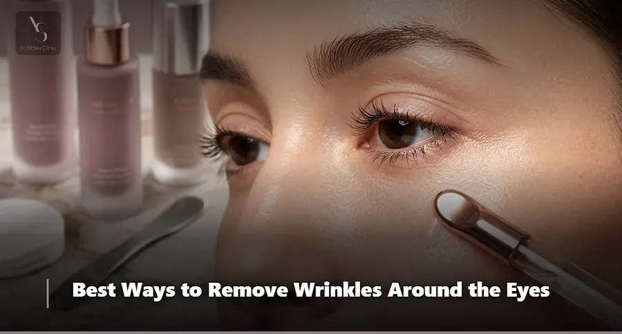 The Best Way to Remove Wrinkles Around the Eyes